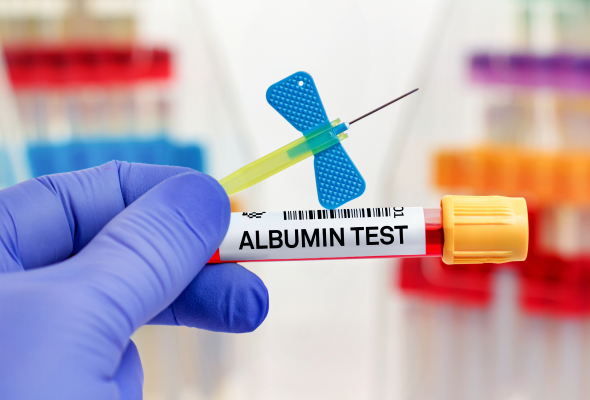 Private Blood Lab in Uxbridge