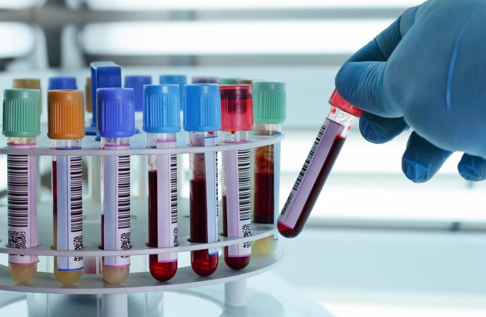 Private Blood Lab in Uxbridge